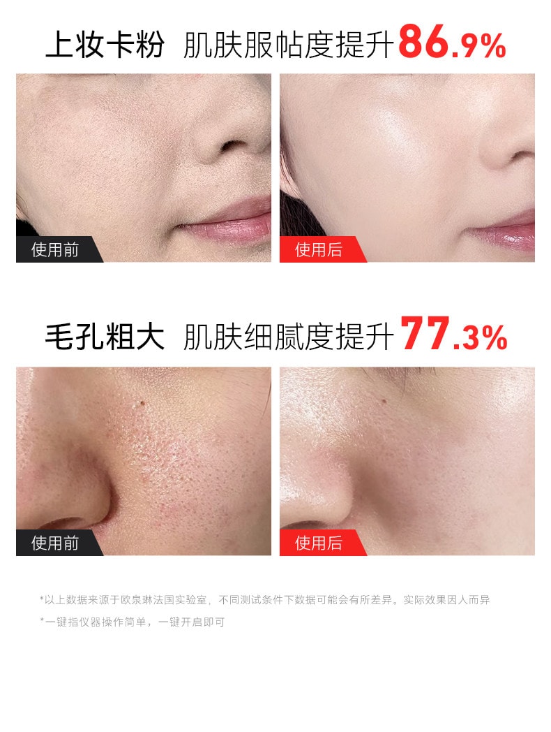【中國直郵】 歐泉琳 高壓注氧儀奈米噴霧補水儀美容儀器精華導入儀蒸臉部家用水光儀器 粉紅色 1份
