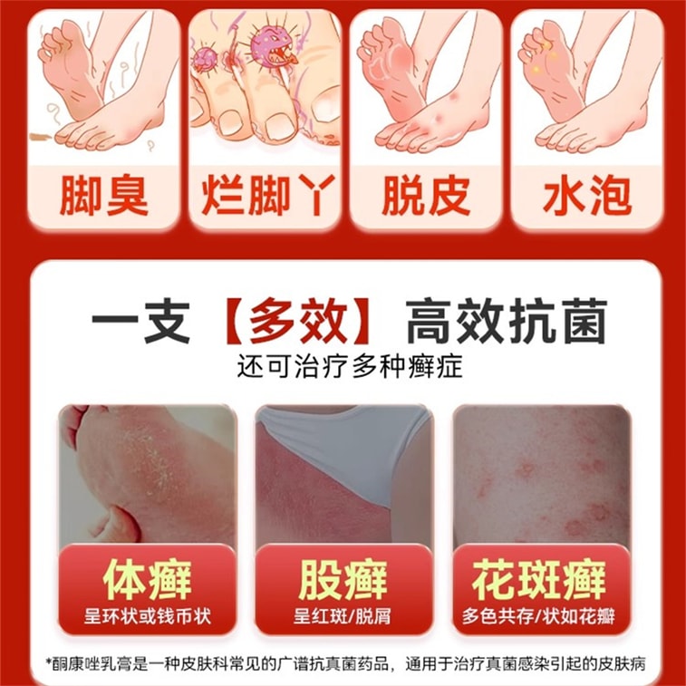 Cream Anti-fungal foot cream for treating fungal infections, relieving blisters, eliminating foot odor and peeling. 19g per pack. 4
