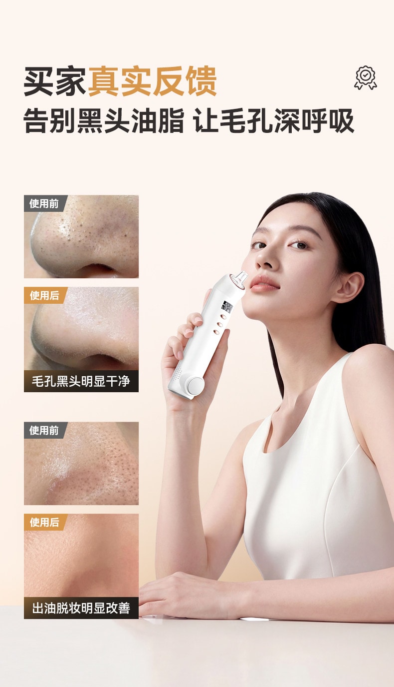 【中國直郵】 歐泉琳 吸黑頭神器家用臉部電動小氣泡去黑頭粉刺毛孔清潔儀器強力吸出器 1份