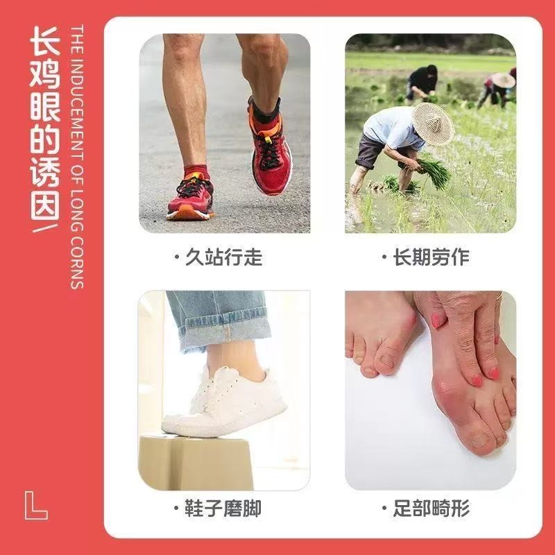 【中國直郵】 甄選好物 葵花雞眼專無痛脫落手足腳底肉刺雞眼腳刺頑固雞眼老繭雞眼貼 1盒/10貼