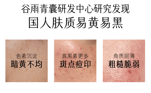  谷雨 【皇牌-经典水乳霜组合】第三代光感水乳霜套装  【美白快准狠】【稳白不反黑】【更适合亚裔肤质】减黄提亮 美白淡斑 修护(光感水150ml+光感乳100ml+美白奶罐50g)