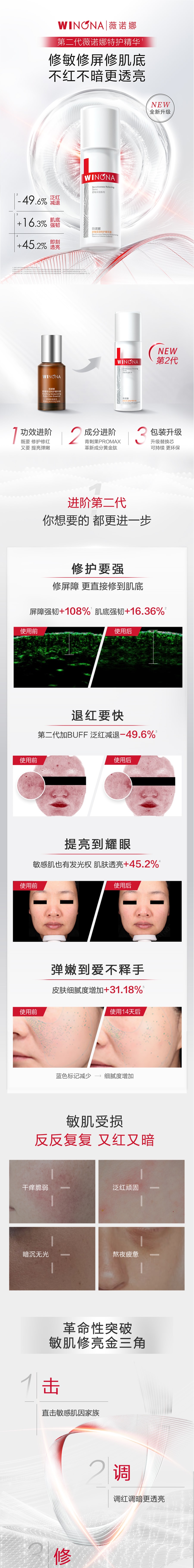 薇诺娜 【品牌爆款】舒缓保湿特护精华液30ml 修护敏感脆弱肌 必囤精华【全场直降叠满赠】(一代/二代)新老包装随机发货【限时买1赠1 售完即止】