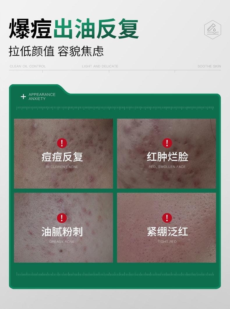 【中国直邮】 韩伦美羽 多效舒缓祛痘膏 红肿痘青春学生控油祛痘精华非修复痤疮 20g/盒