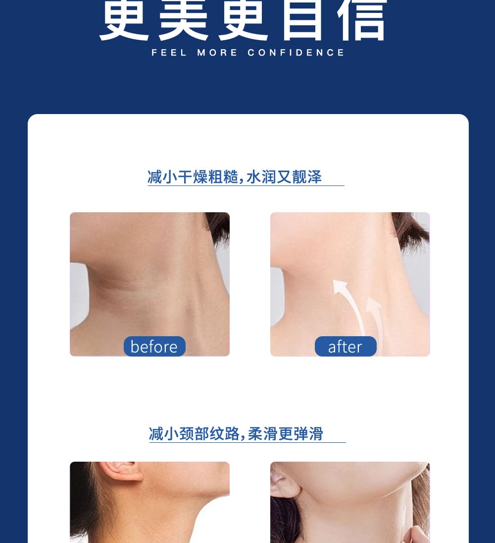 臻羞 烟酰胺多肽颈纹霜【颈纹消失术】颈部按摩霜 淡化颈纹 提拉紧致 按摩滚珠解放双手 50g 敏感肌专用 滋润保湿天鹅颈