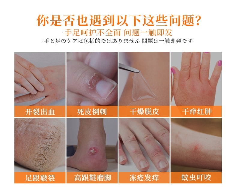  日本 悠斯晶 維生素乳霜 防乾裂 滋潤保濕 護手霜 圖案包裝隨機發 40g