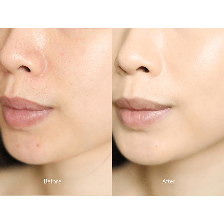 ETVOS||礦物三色遮瑕盤||3.1g 5