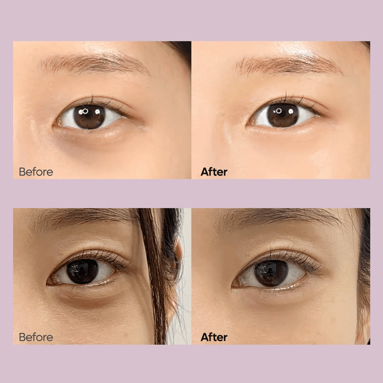 세멘레테 칼슘 다크 스팟 아이 크림, 0.52oz. 4