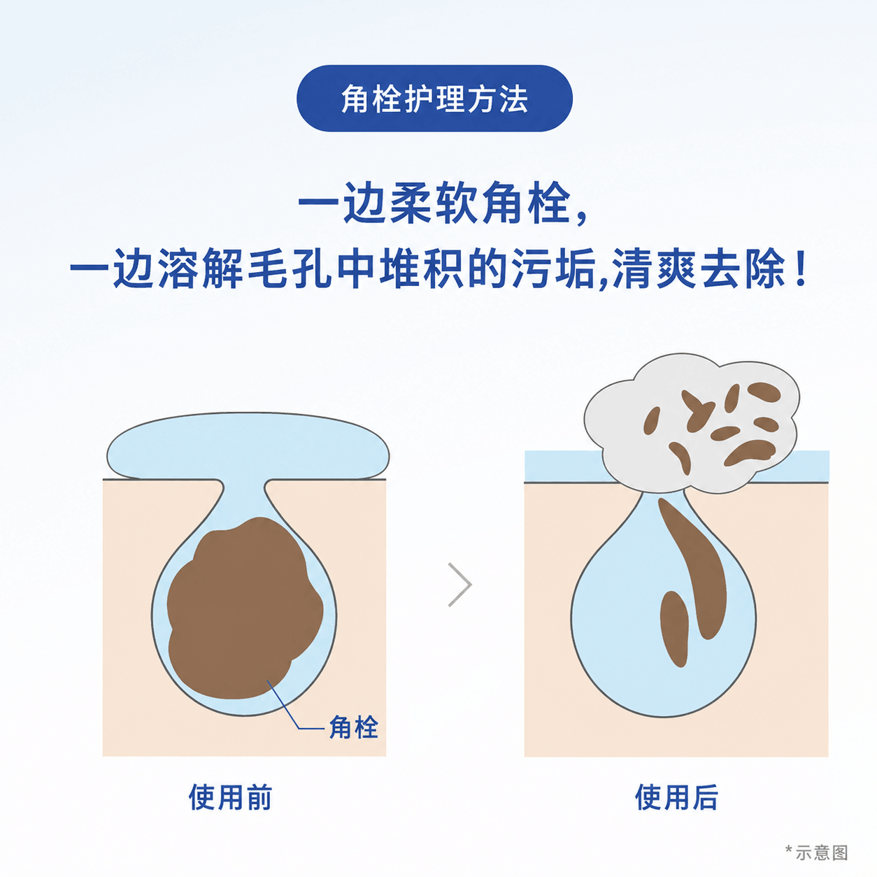 【Livraison directe du Japon】 ORBIS Nettoyant visage anti-acné pour peaux sensibles 120g