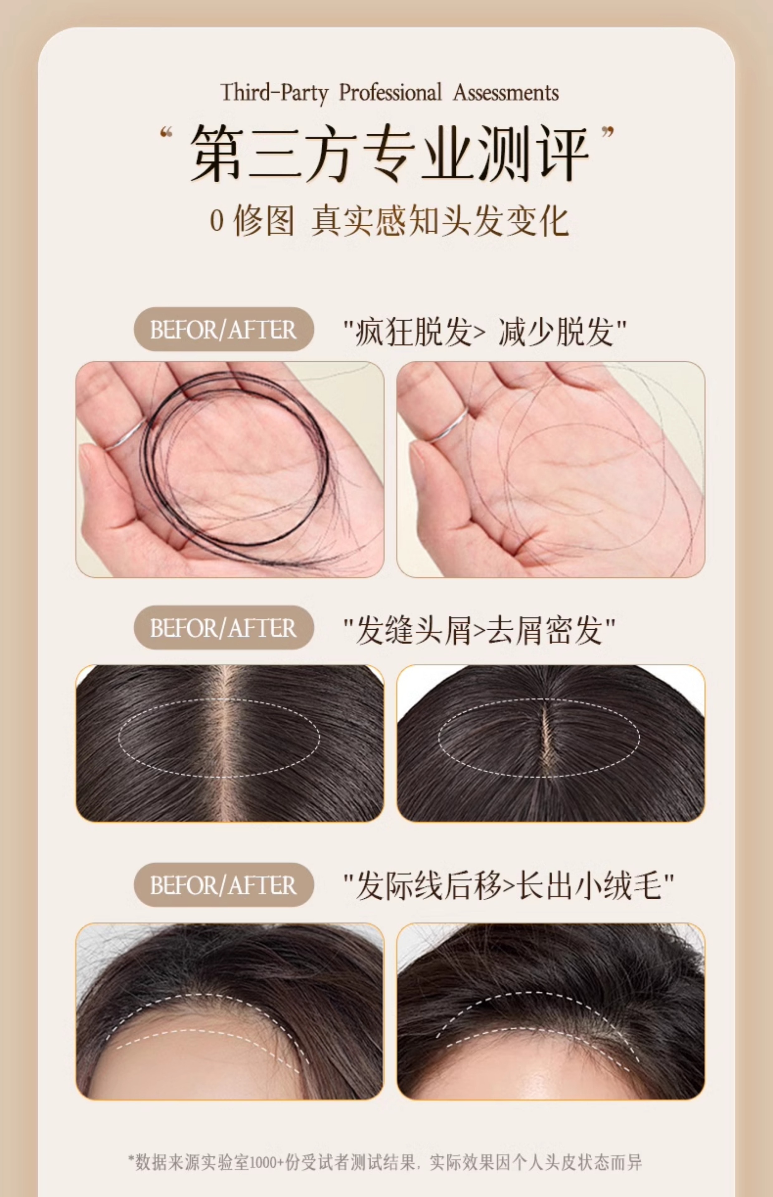 【中国直邮】 新加坡 Kuvive 防脱洗发水 长发育发控油蓬松去屑咖啡因生姜固发脱发洗头膏露 500ml/瓶