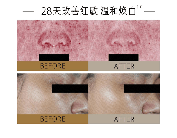 穀雨 【性價比夯爆-美白囤裝2瓶】實驗室淨白瓶【淡斑專研】【28天精準淡斑】 光蘊淡斑煥白精華液【細胞ATP科技】 美白精華 修護保濕【娜扎代言】25ml/瓶