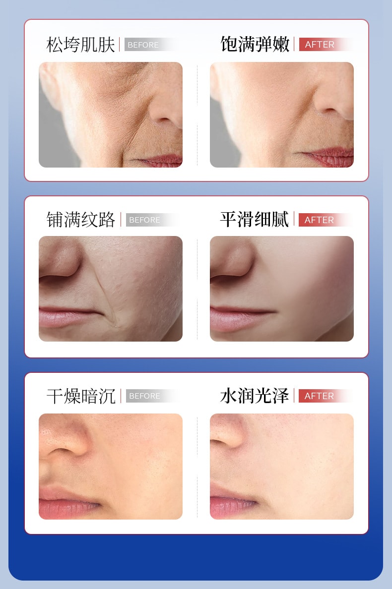 韓倫美羽 重組膠原蛋白抗皺嫩膚霜滋潤保濕修護乳霜補水不乾燥 補水保濕,提亮膚色,曬後修護,滋潤,緊緻,舒緩肌膚,柔潤肌膚 30g