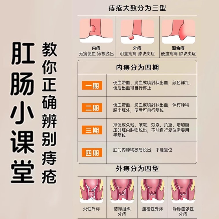 馬応龍【400年の処方、八つの要素：落ち着きのない状態からさよなら】痔座薬　1箱14個入り。腫れ、直腸からの出血、肛門の灼熱痛、痔核、裂肛などの症状を軽減します。清熱・清湿、気血の促進、腫れの軽減、壊死組織の除去、組織再生促進。裂肛、直腸出血、肛門周囲湿疹の治療に。【数量限定、価格割引】 5