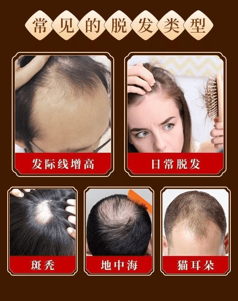【中国直邮】 霸王 毛囊滋养原液育发防脱男女士营养头皮发际线护理液增发密发防脱发 滋养毛囊 改善发缝宽 / 发际线后移 控油去屑头皮营养液 免洗便捷 养出浓密健康发质 熬夜党脱发救星55mL 2盒装