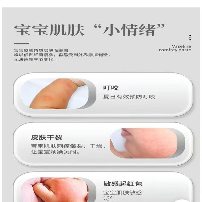 Vaseline Purple Grass Cream for Infants, Young Children, Baby Dingding Soothing Stick Anti Itching Cream Mosquito Bite Elimination Pack 1