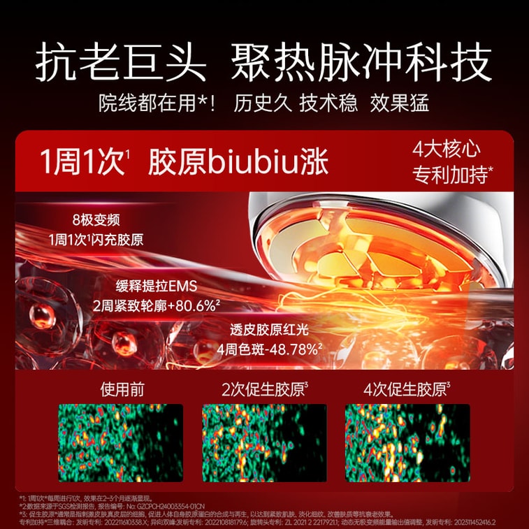 【北美獨家首發送凝膠】 Mesmooth慕蘇小冰鯨射頻美容儀器家​​用臉部提拉緊緻神器眼部冰敷按摩儀嫩膚水光儀流光銀 1件 3