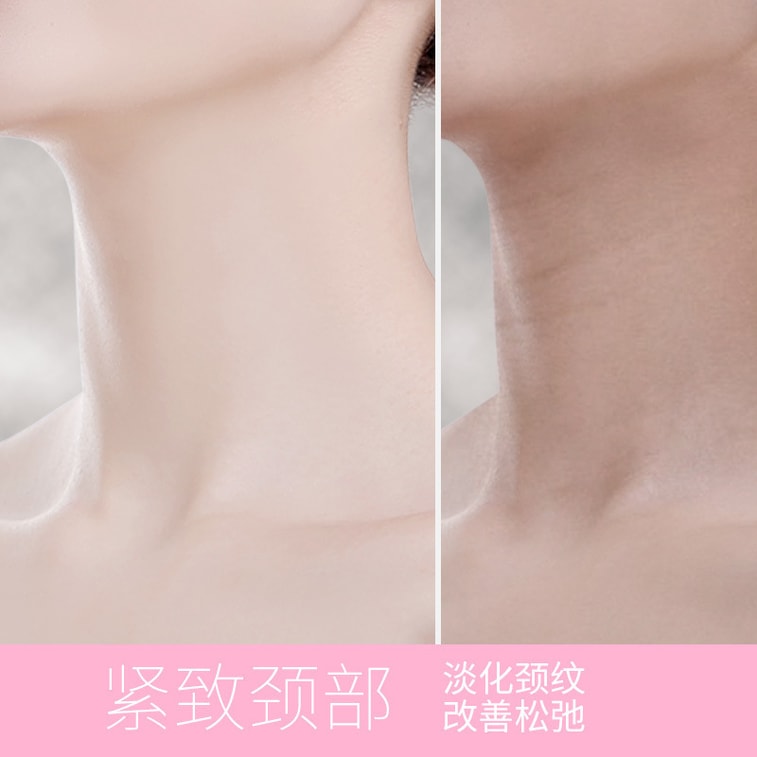 [중국 직배송] 타임스우드 목 마사지기 (1개) - 팔자주름 개선, 마사지 및 탄력 강화에 효과적인 미용 기기. 5