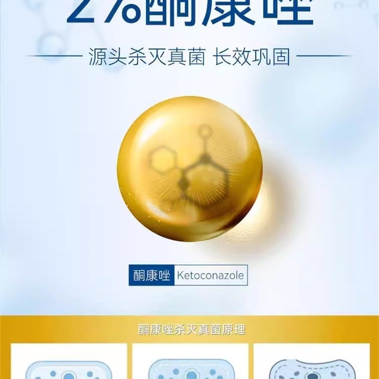 Ketoconazole Lotion Anti-dandruff Anti-itch Shampoo Seborrheic Dermatitis Alopecia 50ml/bottle 3
