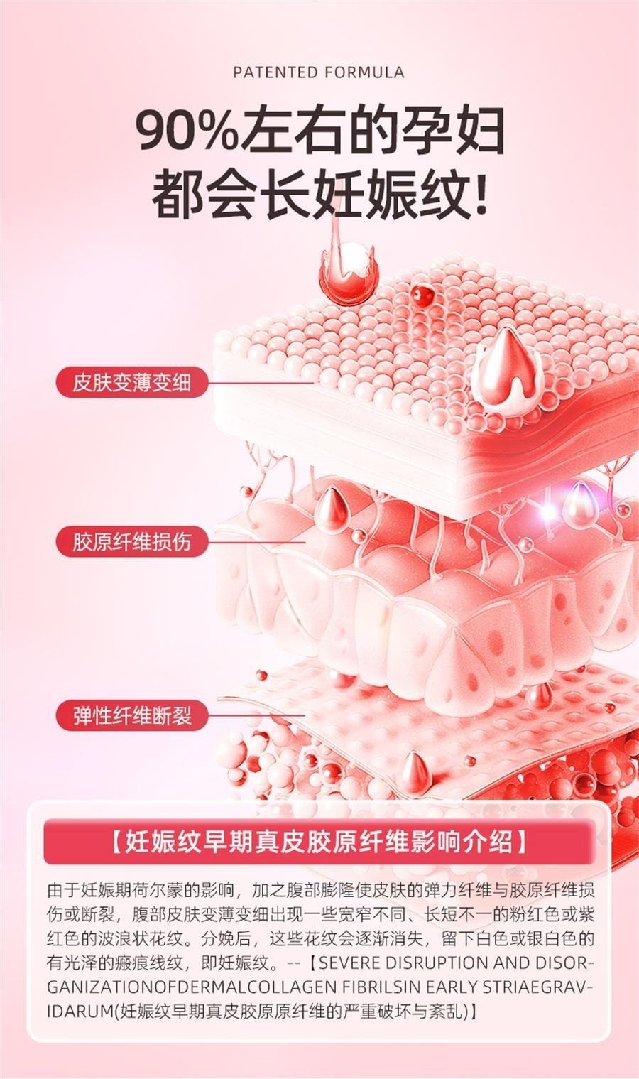 【中国直邮】 纽利安 妊娠纹修复霜 肥胖纹淡化生长纹药膏孕妇产后消除去妊辰纹紧致肚皮 20g/支