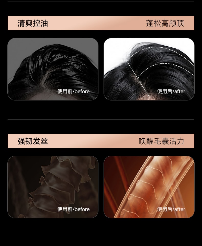 【中国直邮】 和草集 去屑控油洗发水 蓬松止痒改善头皮清爽不油腻 300ml/瓶