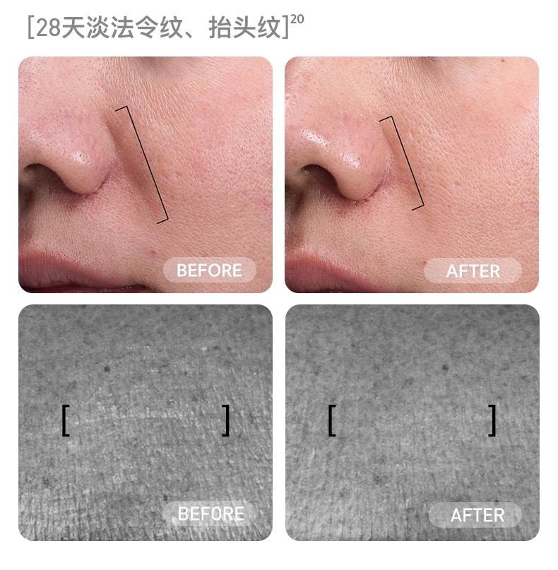 【品牌国内同价】FLOSSOM花至 小紫弹智能射频美容仪器 家用智能美容仪 多功能分区护理 脸部&颈部提拉紧致 速渗透 强透亮FR200 1 件