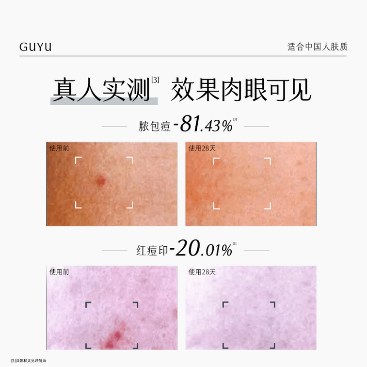 穀雨 男士套裝-水乳潔面素顏霜 控油祛痘【淘寶TOP 1熱銷榜男士護膚套裝】【性價比夯爆】【國人男士專研】節日/生日禮物 (洗面乳120g+爽膚水120ml+乳液80ml+素顏霜50g+男士禮盒) 6