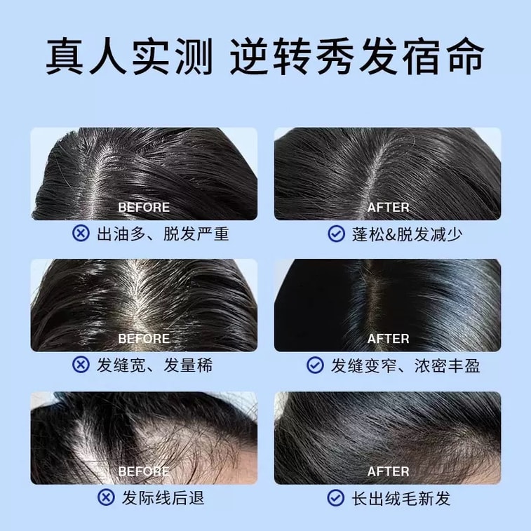 【Strong Resilient Hair Roots Anti-Breakage】Anti-Hair Loss and Oil Control Shampoo 100ML for Fine Flat Hair A Savior for Severe Hair Loss Volumizing Shampoo What to Do When Hair Breaks Easily Hair-Firm 6