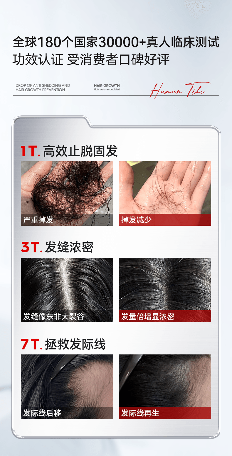 【中国直邮】 新加坡 Kuvive 生姜育发液 生长发增发密发头皮精华液头发护理剂发际线快速长 100ml/瓶