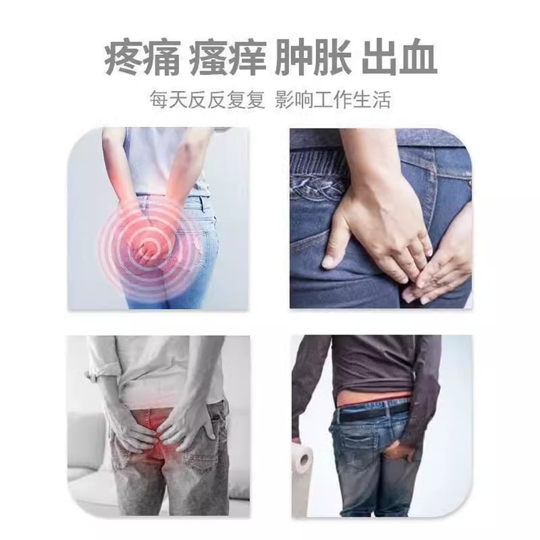 【中國直郵】太寧 西安複方角菜酸酯栓 痔瘡藥腫脹搔癢痛癢疼痛出血內痔 6枚/盒 4