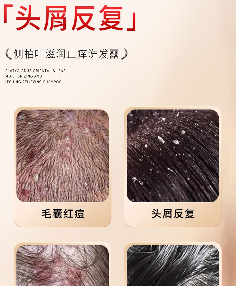 南京同仁堂 側柏葉何首烏植物洗髮水生薑去屑止癢控油防掉脫純草本增密髮 帶走油脂和頭屑,洗完頭皮清爽不癢,髮絲蓬鬆順滑,自帶健康光澤 400ml/瓶