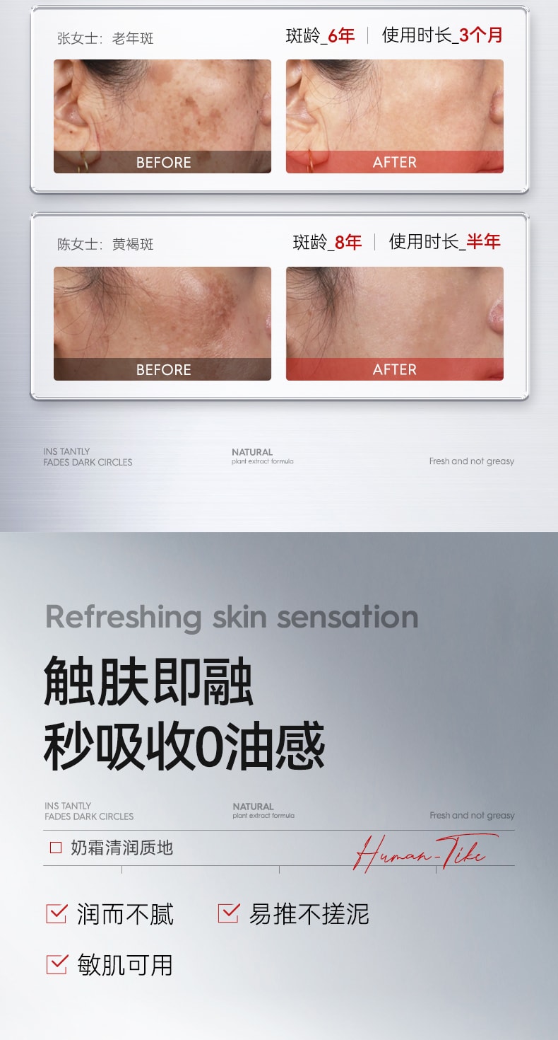 【中国直邮】 新加坡 Kuvive 焕白净斑霜 377祛黄褐斑面霜 美淡化色斑去老年斑雀斑白保湿滋润 30g/瓶