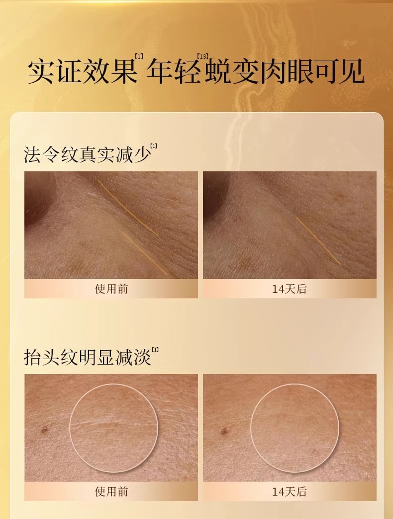 【中國直郵】 FanBeauty 靈芝白松露淡紋油膏面膜 滋養補水保濕 雙艙協同 奢養年輕 5片/盒【小紅書爆款推薦】