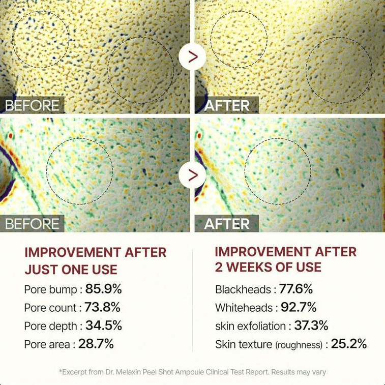 【韓國直郵】 韓國 Dr.Melaxin 米柔膚精華 80ml 亮白淡化癍印去角質 9
