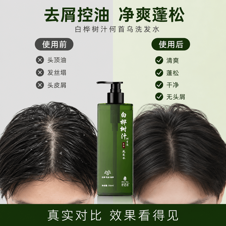 Birch Sap Herbal Volumizing Shampoo 350ml / 11.83 fl Oz, Pack Of 2 | Oil Control Shampoo For Fine Flat Hair, Lightweight Scalp Care & Flake Care 3