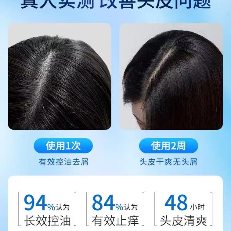 【 Effectively Inhibit Malassezia 】 200ml selenium disulfide shampoo for dandruff and itch relief, targeting seborrheic hair follicles 5