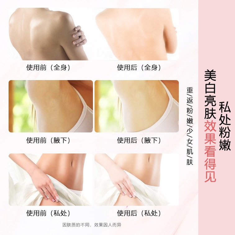 南京同仁堂 全身柔嫩乳 美白乳 30ML デリケートゾーンのピンク化、色素沈着除去、乳輪の黒ずみ除去、脇の黒ずみ除去、美白乳、脇の美白、脇の黒ずみ、膝の黒ずみ除去、部分的な黒ずみ除去、全身美白、ビキニラインケア、新旧パッケージが切り替わります、色素沈着除去、クリーム、ビキニライン美白、美白チェック 3