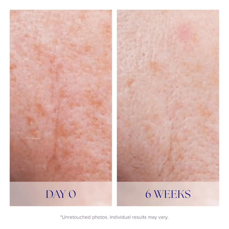 Active Serum 15 mL: Clarifying, Anti-Acne, Anti-Aging Facial Treatment for Radiant Skin 3