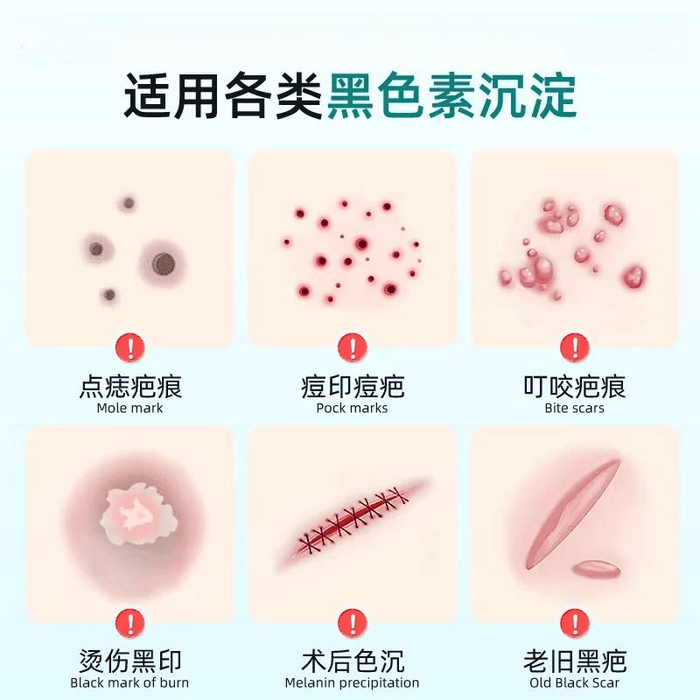 【中国直邮】 纽利安 祛痘印修复淡化痘印去黑色素沉淀去除脸部点痣20g*1个 3