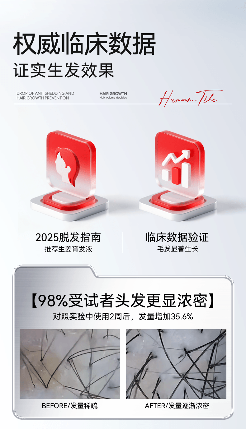 【中国直邮】 新加坡 Kuvive 生姜育发液 生长发增发密发头皮精华液头发护理剂发际线快速长 100ml/瓶