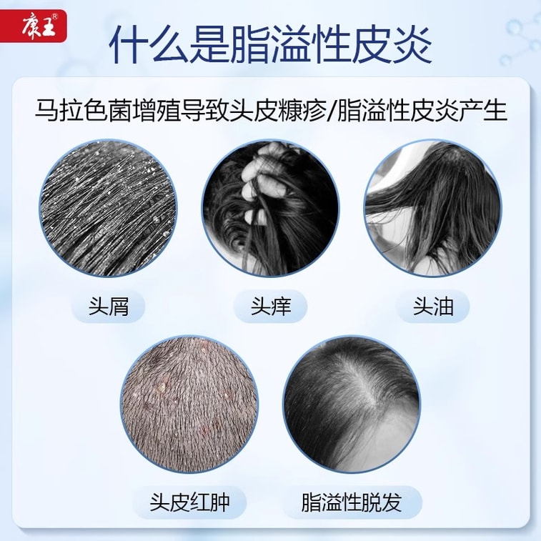 Compound ketoconazole Shampoo for the treatment of fungal seborrheic ...