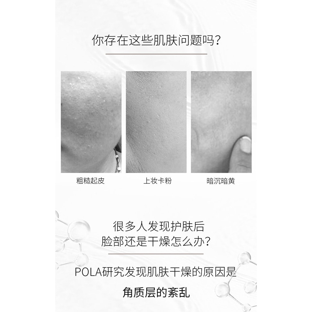 【日本直邮】POLA宝丽 MOISTISSIMO高保湿敏感化妆水125ml