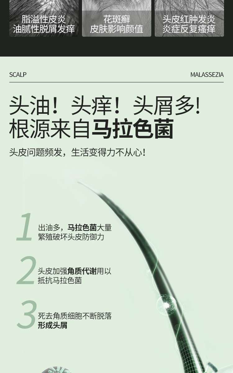 【中国直邮】 青丝几何 二硫化硒洗剂 脂溢性皮炎去屑洗发水小青瓶花斑癣汗癣止痒 120g/盒