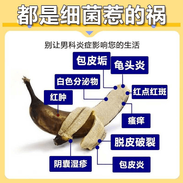 [중국 직배송] 화칭 클로트리마졸 크림 (백선, 진균 감염 및 귀두염 치료용), 10g*1개 3