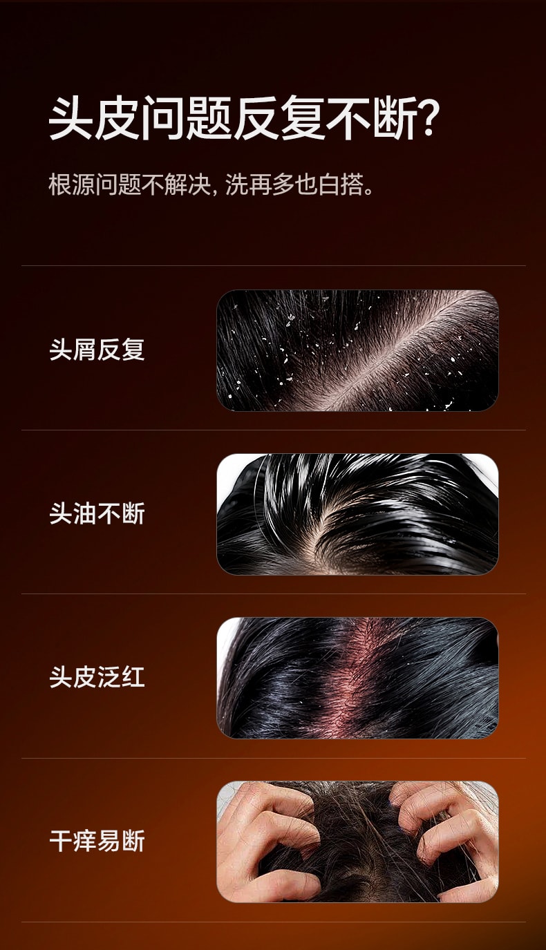 【中国直邮】 和草集 去屑控油洗发水 蓬松止痒改善头皮清爽不油腻 300ml/瓶