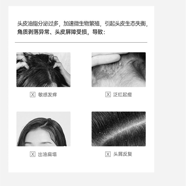 スペス オイルコントロール フラッフィーシャンプー ビサボロール配合 かゆみ止め、フケ防止、皮脂除去効果持続シャンプー 500ml 3