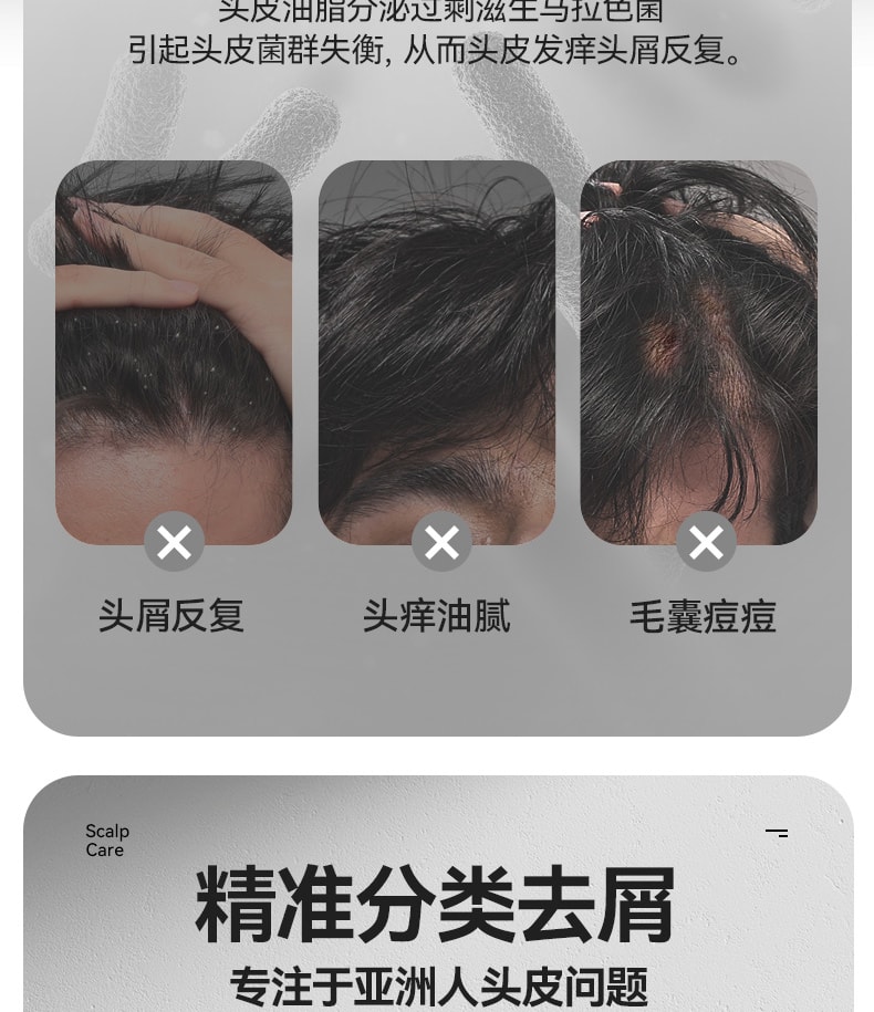 【中國直郵】 和草集 小藍瓶止癢去屑二硫化硒洗髮水 平衡頭皮微生態 淨屑止癢不反复 鳶尾誘惑香型 300ml/瓶