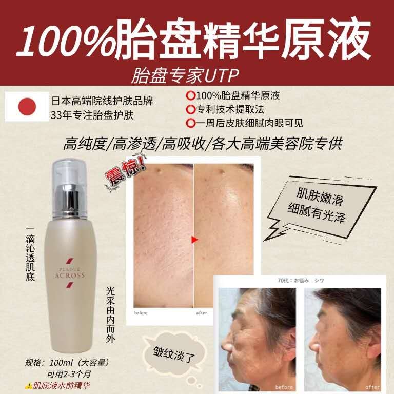 日本直邮】 日本日本其他院线UTP PLADUE ACROSS胎盘原液精华100ml水前