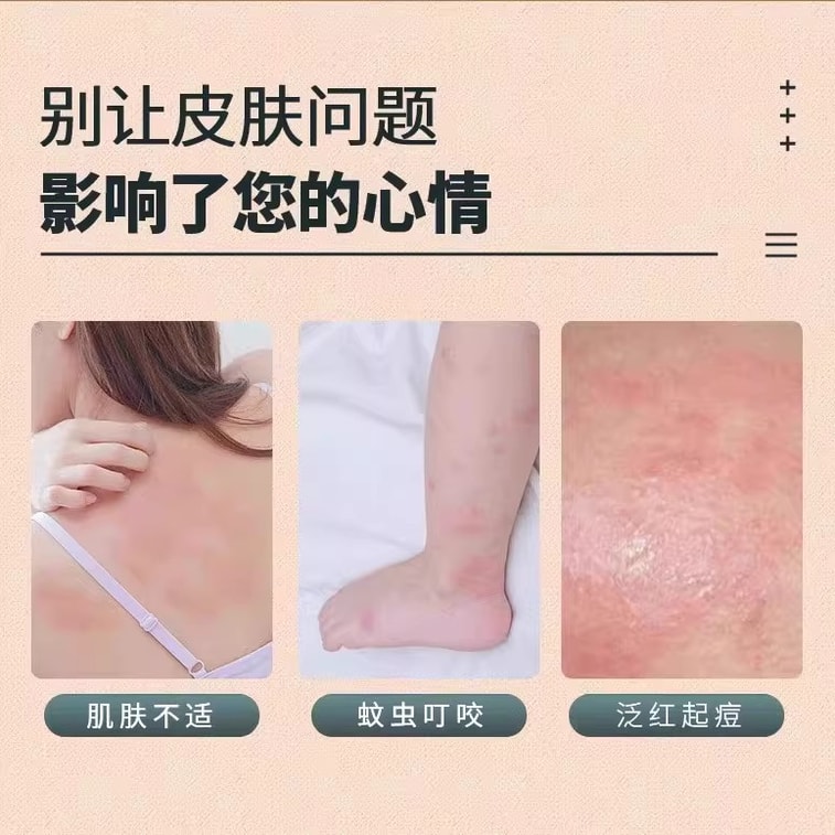 Sulphur Ointment Cunnilingus Mite Itch Relief Mite Removal Ointment Eczema Skin Antibacterial 50g/box 5