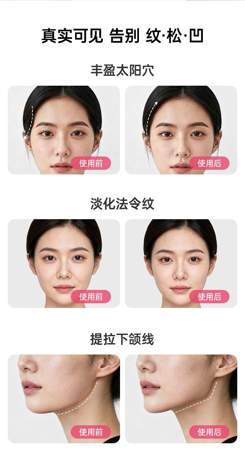 佑美 咬肌面部瑜伽球 瑜伽训练器 外轮廓肌肉 下颚线 大小脸 太阳穴凹陷 面部瑜伽球 粉色 1个