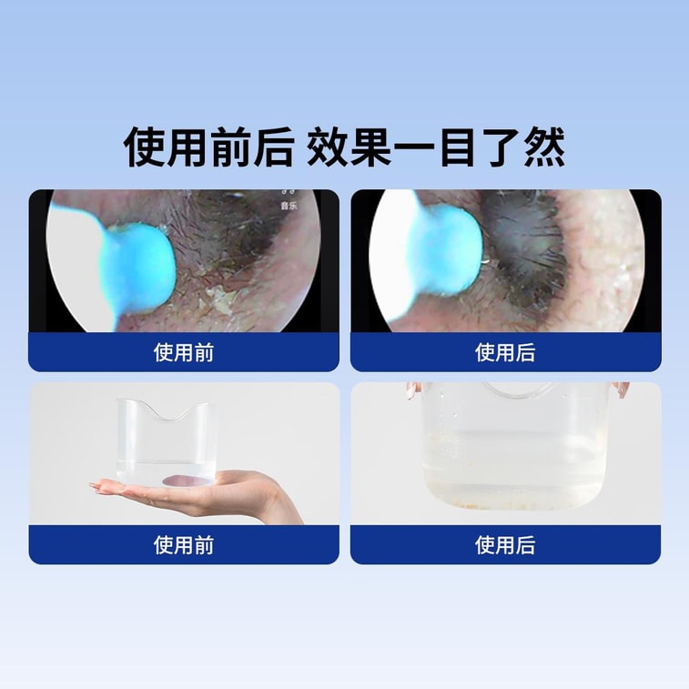 Electric ear washer 4