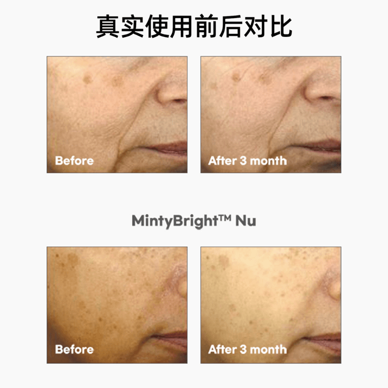 I'MO Inositol Brightening Drink 20g*14 Sticks/Box 3